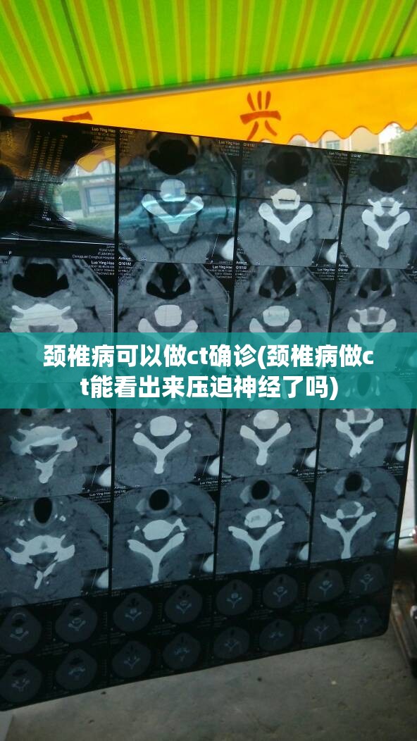 颈椎病可以做ct确诊(颈椎病做ct能看出来压迫神经了吗)