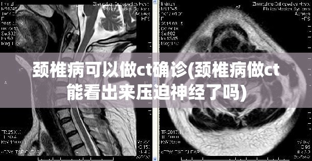 颈椎病可以做ct确诊(颈椎病做ct能看出来压迫神经了吗)