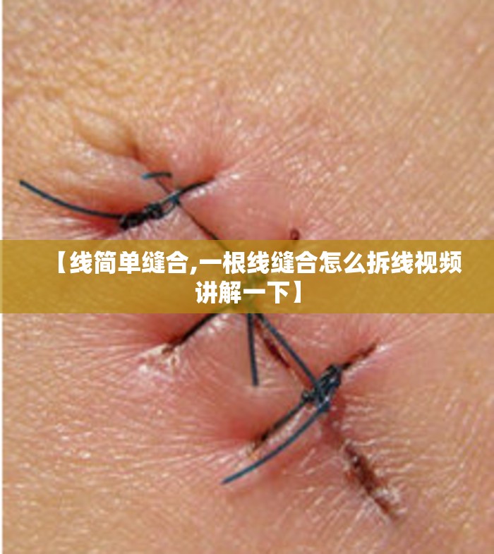 【线简单缝合,一根线缝合怎么拆线视频讲解一下】 【线简单缝合,一根线缝合怎么拆线视频讲解一下】