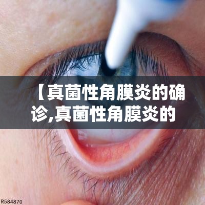 【真菌性角膜炎的确诊,真菌性角膜炎的中药配方】