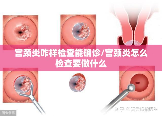 宫颈炎咋样检查能确诊/宫颈炎怎么检查要做什么