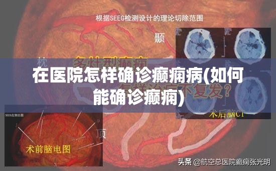 在医院怎样确诊癫痫病(如何能确诊癫痫) 在医院怎样确诊癫痫病(如何能确诊癫痫)