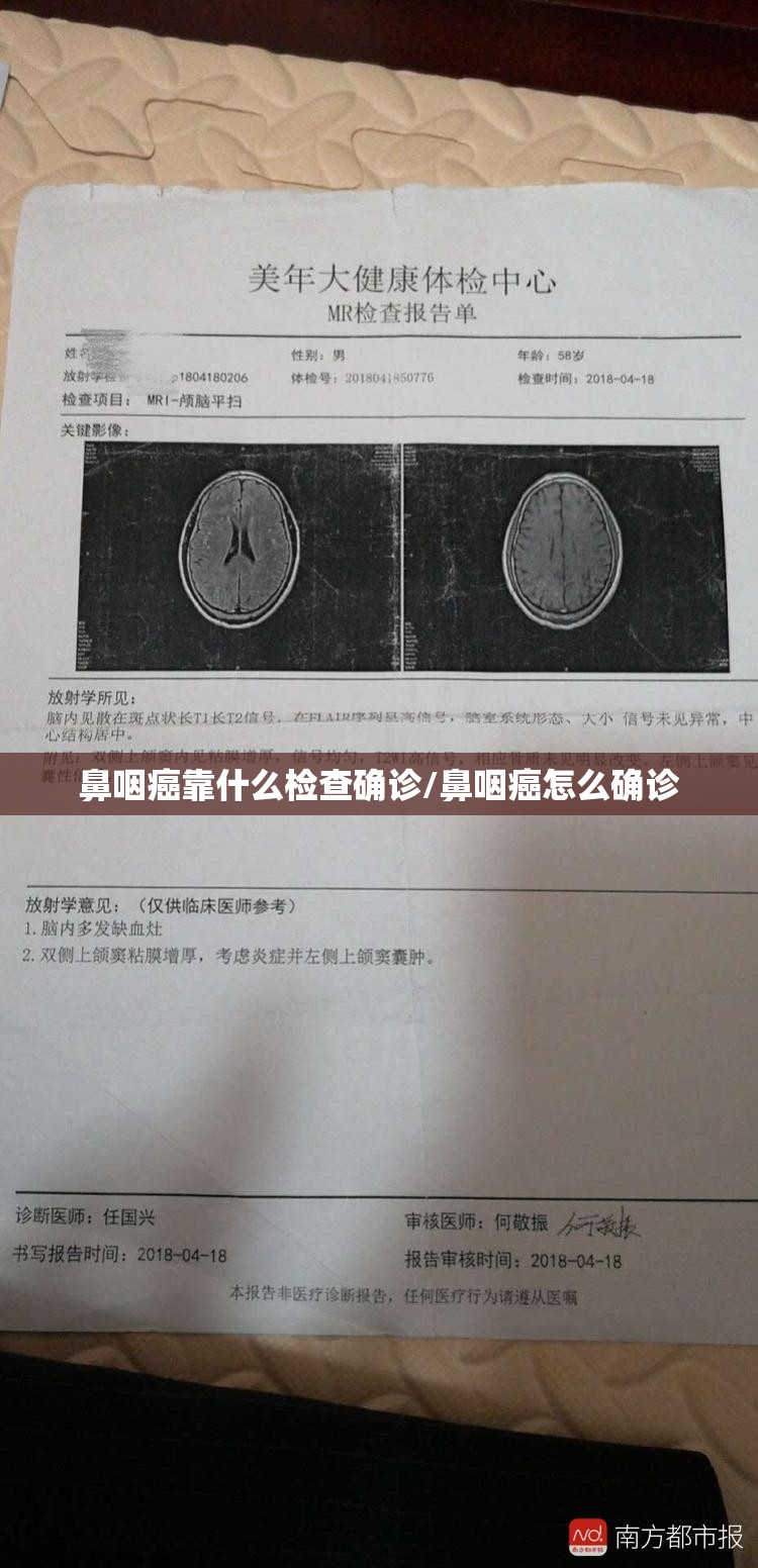 鼻咽癌靠什么检查确诊/鼻咽癌怎么确诊