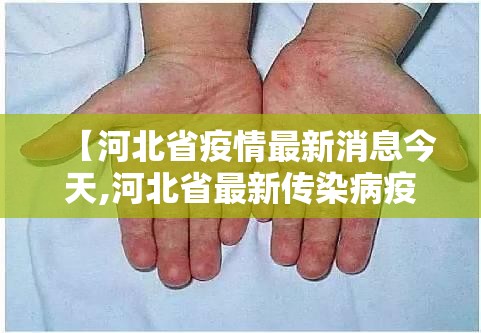 【河北省疫情最新消息今天,河北省最新传染病疫情】