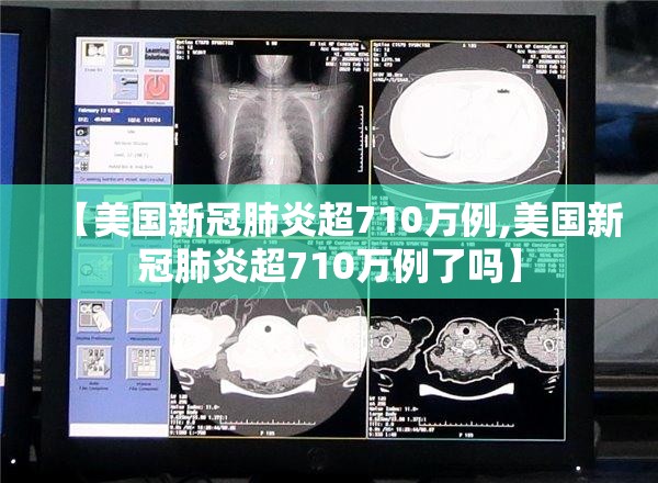 【美国新冠肺炎超710万例,美国新冠肺炎超710万例了吗】 【美国新冠肺炎超710万例,美国新冠肺炎超710万例了吗】