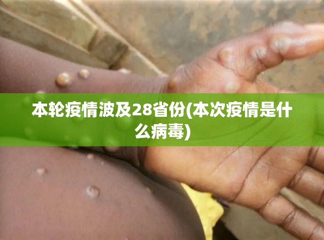 本轮疫情波及28省份(本次疫情是什么病毒) 本轮疫情波及28省份(本次疫情是什么病毒)
