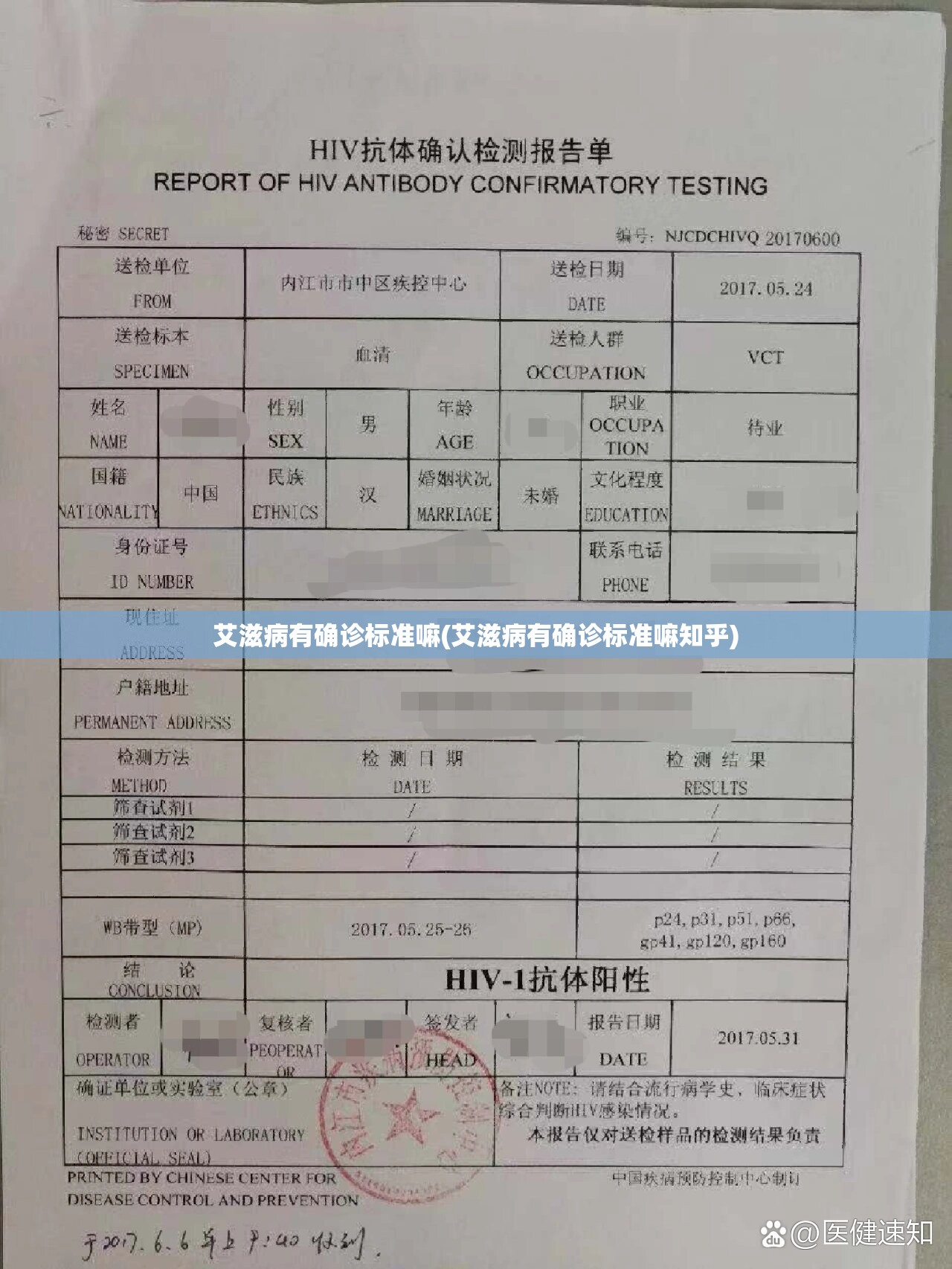 艾滋病有确诊标准嘛(艾滋病有确诊标准嘛知乎)